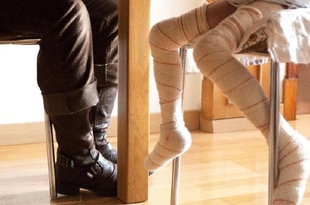 Андалусия выделит миллионы евро на лечение пациентов с «кожей бабочки»